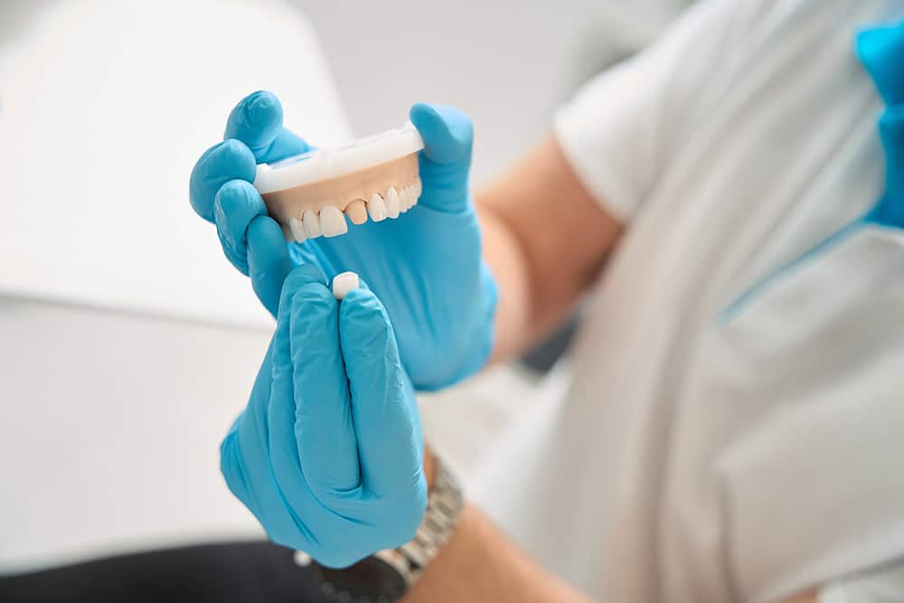 A dental professional holding a pari of fake teeth showing how a dental crown works.